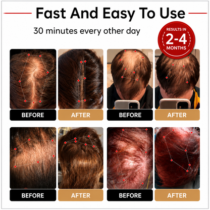 Red Light Therapy Regrowth Cap